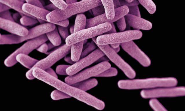 Auch Tuberkulose-Bakterien nutzen ein geschwächtes Immunsystem aus.