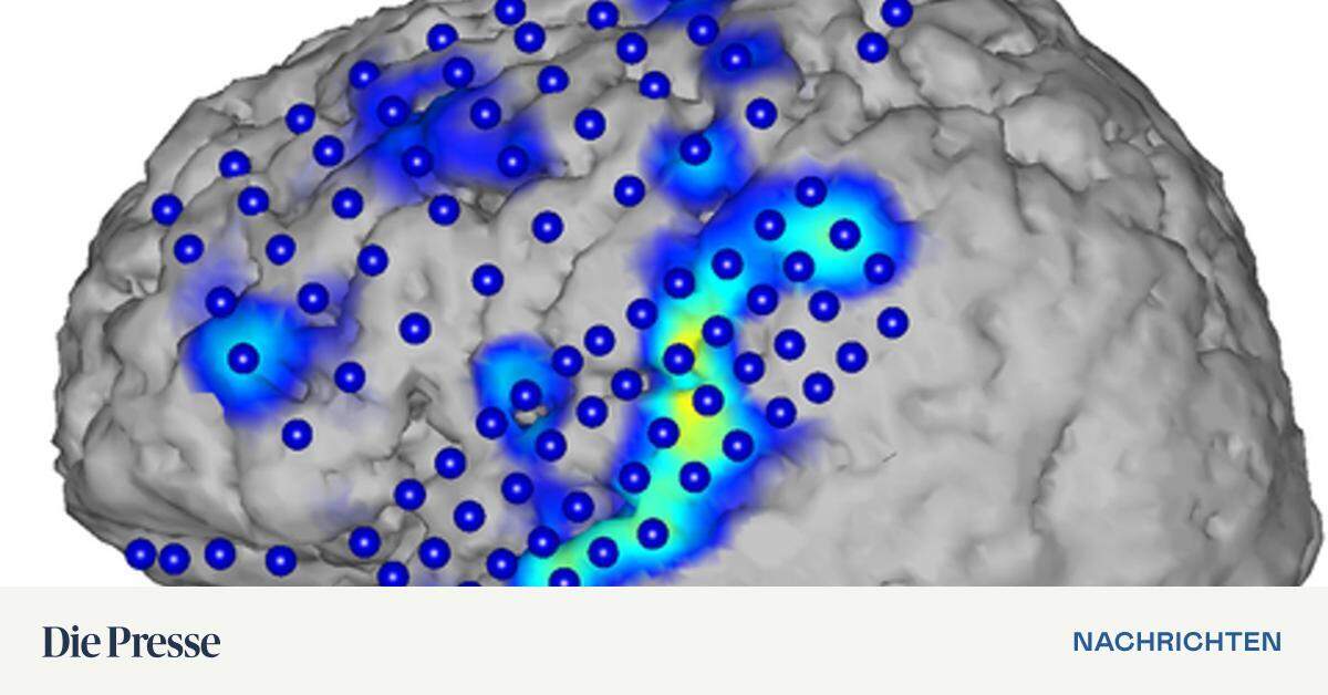 Forscher Können Gedanken Lesen – DiePresse.com