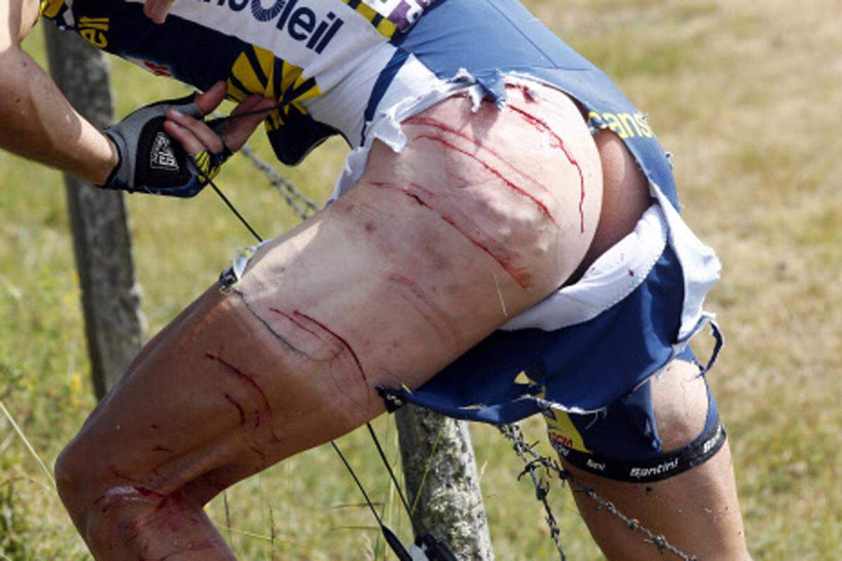 Der Radfahrer Johnny Hoogerland nach seinem Sturz bei der Tour de France 2011.