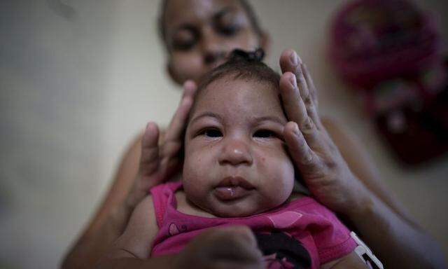 Rosana Vieira Alves fixes the hair of her 4-month-old daughter Luana Vieira, who was born with microcephaly, at their house in Olinda