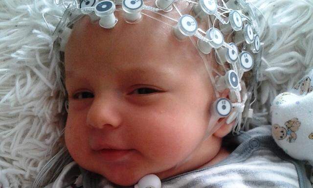 128 Elektroden geben im EEG Einblick in die Gehirnströme des Babys.