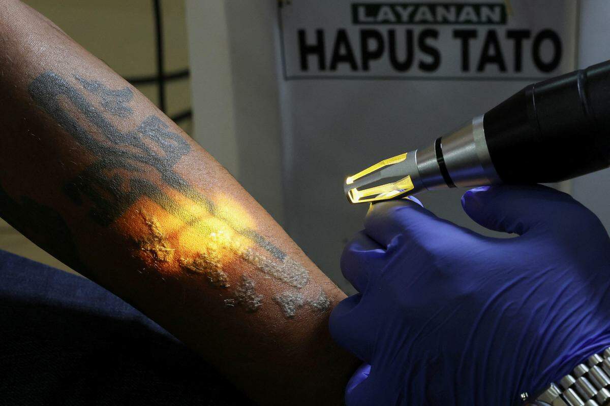26. März. In Jakarta, Indonesien, gibt es ein kostenloses Tattoo-Entfernungs-Programm während des Ramadan.