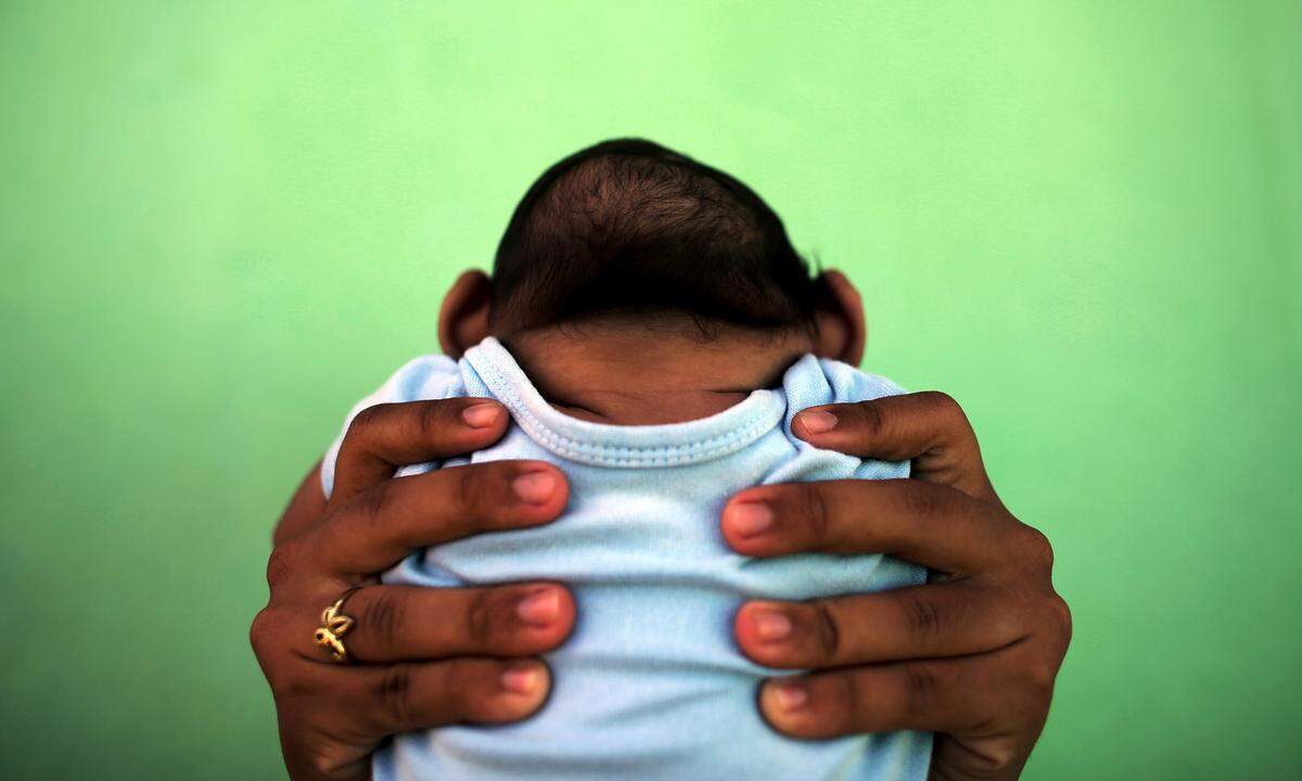 11. Februar 2016. Vor allem in Brasilien gab es eine Häufung von Geburten von Babys mit Mikrozephalie aufgrund des Zika-Virus'. Mehr als 3000 Kinder kamen großteils schwerst behindert auf die Welt - so auch der Sohn der 26-jährigen Jackeline in Olinda.