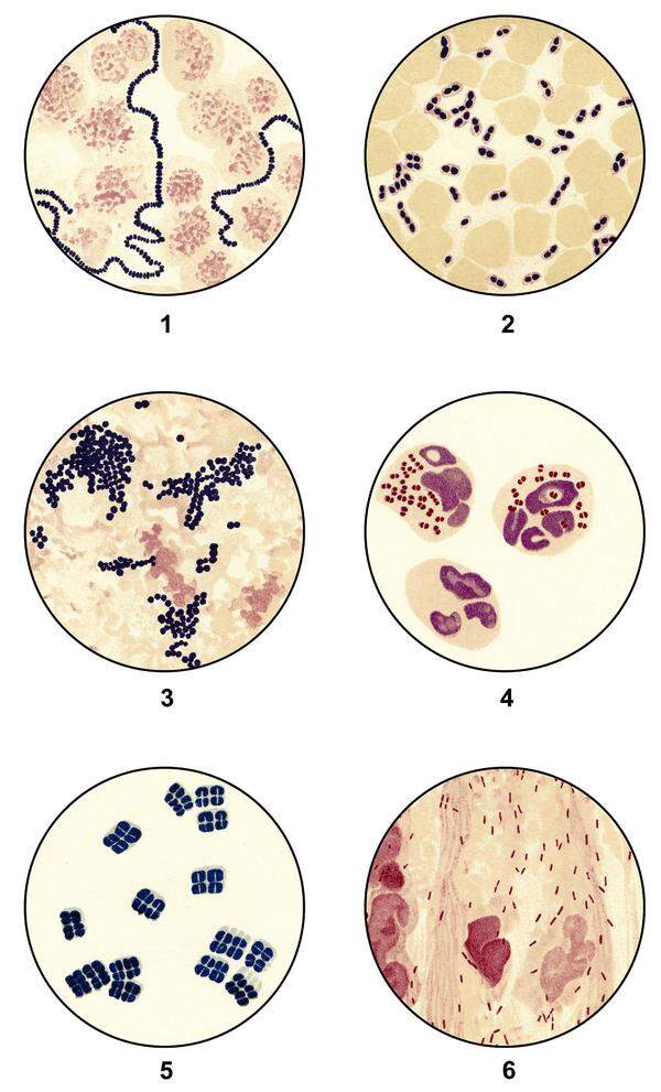 Pneumokokken sind Bakterien, die die Schleimhaut im Bereich der Atemwege besiedeln und vor dort aus Infektionen auslösen. Pneumokokken verursachen bei Säuglingen und Kleinkindern schwere invasive Erkrankungen (Sepsis und Hirnhautentzündung), Lungenentzündung und häufig Mittelohrentzündung. Bei Senioren verläuft eine Pneumokokkenerkrankung häufig tödlich.- im Gratisimpfprogramm für Kinder