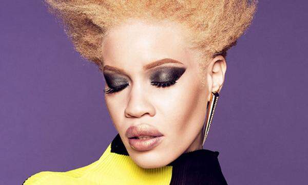 Diandra Forrest ist das Gesicht der Kosmetikfirma "Wet n Wild", damit ist sie das erste Model mit Albinismus, das als Testimonial einer großen Kosmetikkampagne engagiert wurde.