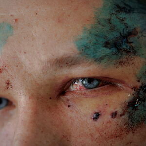 Eines von Zigtausenden Kriegsopfern: Sergej wurde bei einem Raketenangriff auf Charkiw verwundet. 