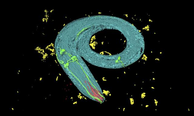 C. elegans: Solche Würmchen zeigten das Phänomen nobelpreiswürdig klar.