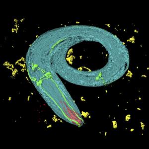C. elegans: Solche Würmchen zeigten das Phänomen nobelpreiswürdig klar.
