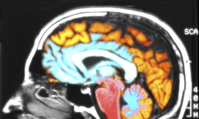 Bildgebende Verfahren machen die Dynamik im Gehirn sichtbar.