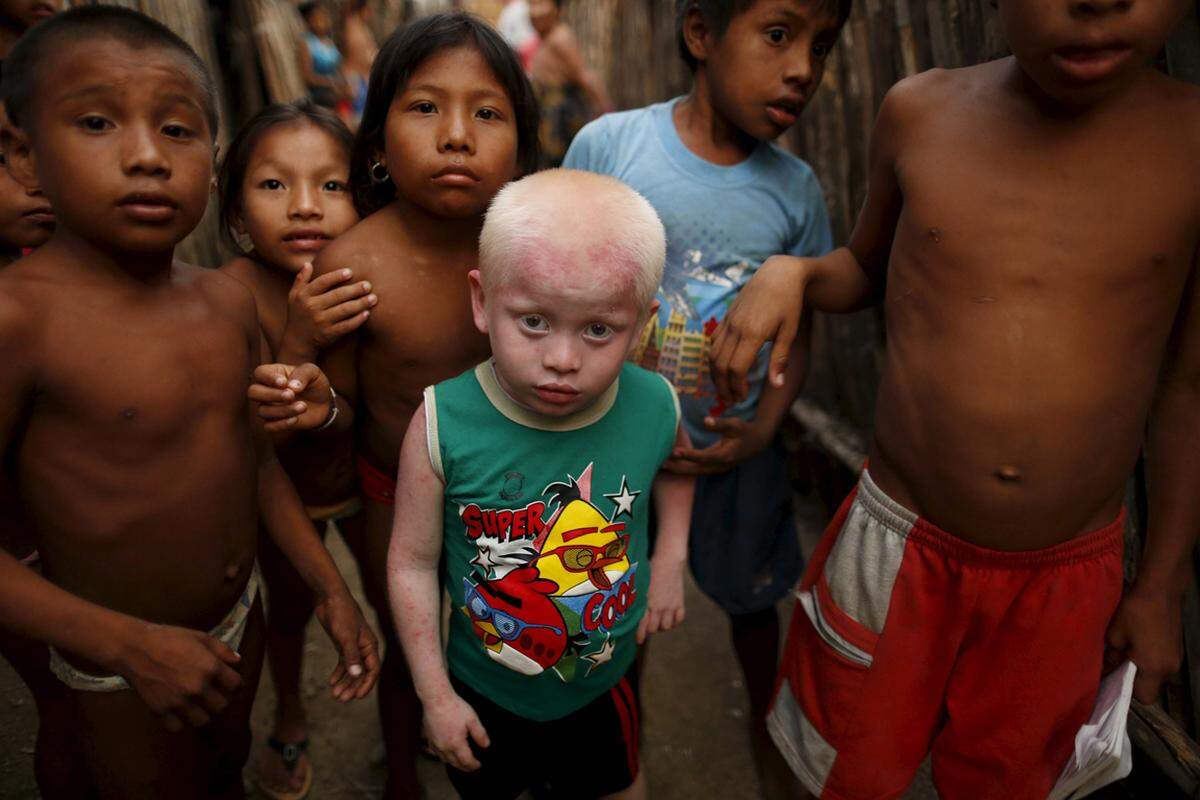 Rund 80.000 Guna leben in Panama und den 365 palmenbedeckten Inseln des mittelamerikanischen Staates. Eines von 150 Kindern kommt mit Albinismus auf die Welt.