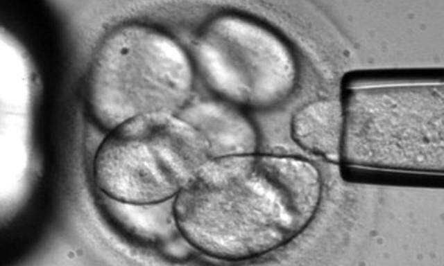Verbietet Patente embryonale Stammzellen