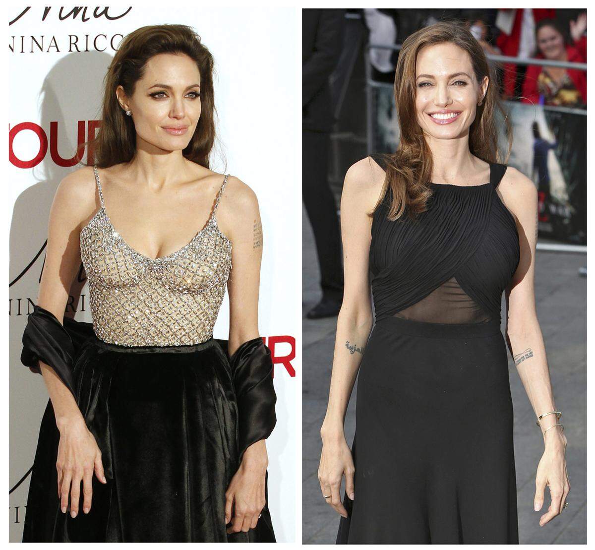 Vor zwei Jahren hat sich Jolie ihre Brüste und im März auch ihre Eierstöcke entfernen lassen. Sie hatte Angst vor Krebs, an dem ihre Großmutter, ihre Tante und ihre Mutter starben. Sie trat eine Diskussion los und wurde für viele Frauen zum Vorbild.