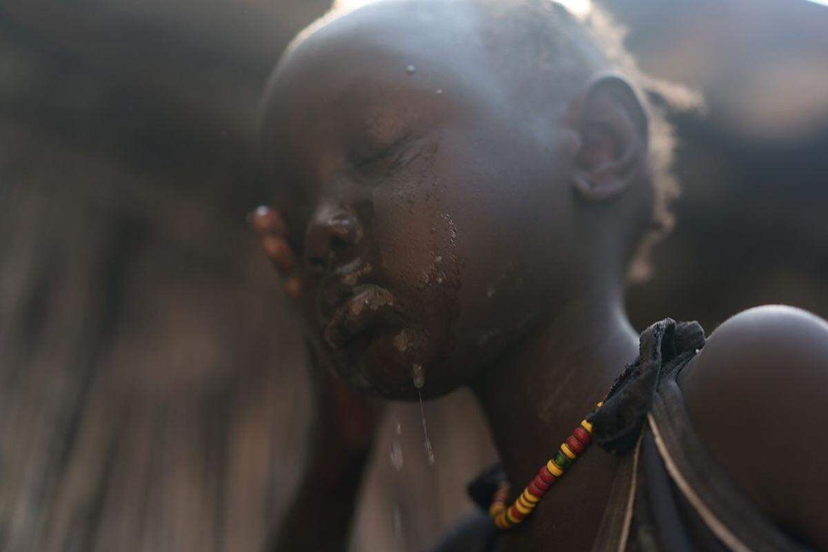 Derzeit leben 95.000 Menschen am UN-Stützpunkt bei Bentiu. Fast 40 Prozent von ihnen sind Kinder, die jünger als fünf Jahre sind. Mangelernährung unter den Jüngsten ist ein großes Problem. Und die anhaltenden Kämpfe zwischen Regierung und Oppositionskräften könnten den Hunger noch massiv verschärfen, warnt die Hilfsorganisation Care. In dem kommenden Monaten könnten im ganzen Land 4,8 Millionen zu wenig zu Essen haben, sagt die UNO.