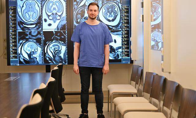 Der Wiener Patric Kienast erkennt an Bildern aus der Magnetresonanztomografie (MRT), wie Einflüsse auf das Gehirn der Ungeborenen wirken.