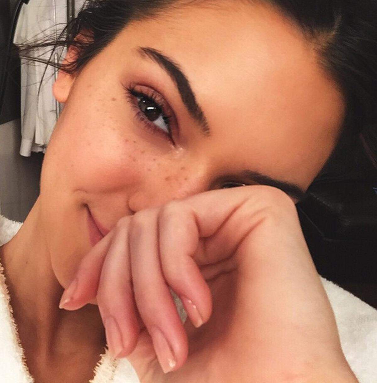 Schwester Kendall Jenner zeigt ihre Sommersprossen.