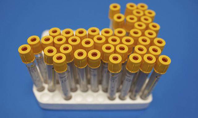 Virus Outbreak Britain Antibody Test