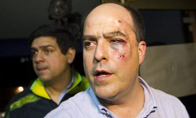 Verletzte bei Schlägerei in venezolanischem Parlament 