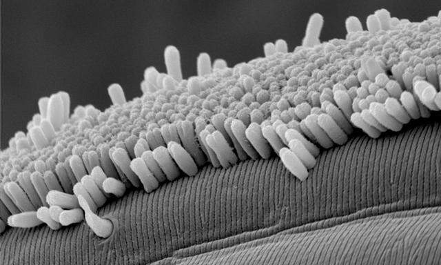 Die stäbchenförmigen Bakterien verlieren auch bei der Zellteilung nie den Kontakt zur Oberfläche des Wurms.