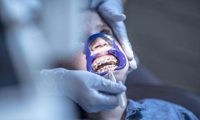 Seit Beginn der Aktion Mitte 2015 wurden rund 25.400 Anträge für eine Gratis-Zahnspange gestellt.