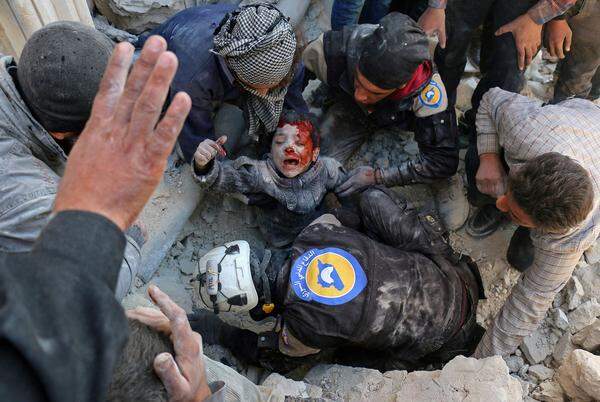 Ameer Alhalbi dokumentierte die Rettungsaktionen von "Weißhelmen" und anderen Freiwilligen in Syrien, die nach Luftanschlägen in Aleppo verschüttete Kinder bergen. Dieses Foto stammt aus einer Serie - und gehört noch zu den weniger brutalen. 
