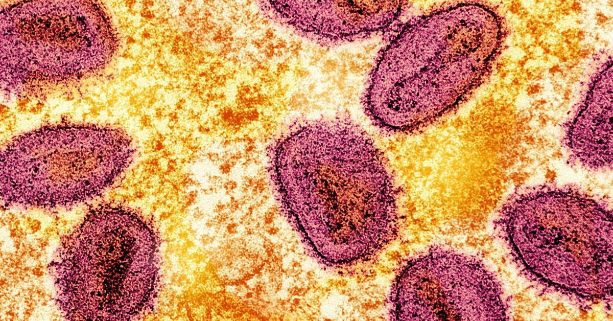 mpox-erster-fall-mit-neuer-variante-in-deutschland