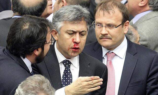 Member of parliament from Republican People´s Party Ali Ihsan Kokturk´s nose bleeds in Ankara