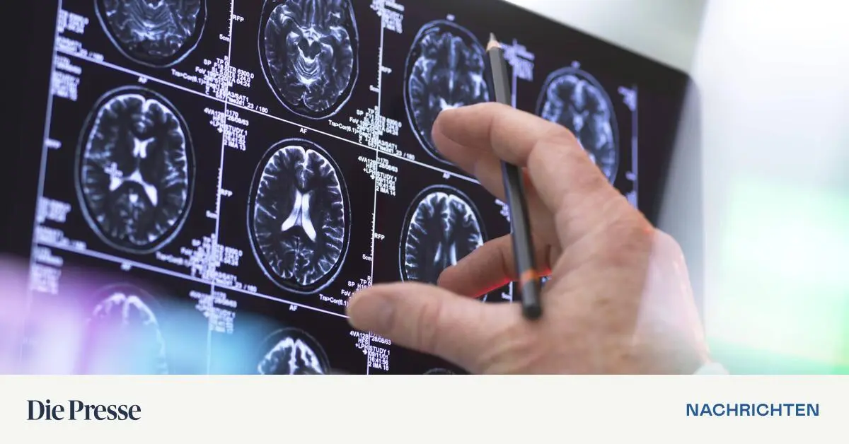 Neuen-Alzheimer-Mittel-haben-mehr-Risiken-als-Nutzen