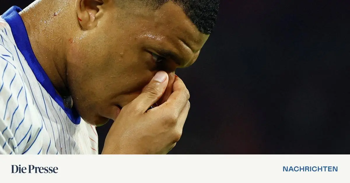 “Suggestions for masks?”  Mbappe's broken nose has been confirmed