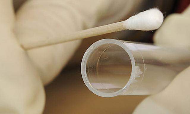 Mit Wattestäbchen wird eine DNA-Spur genommen