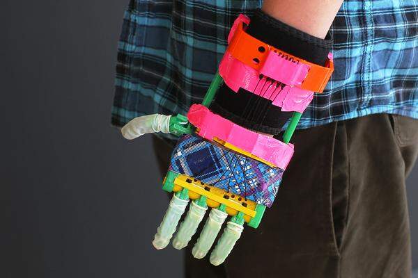 Der 12-Jährige Leon McCarthy trägt eine solche Handprothese. Als er sich einen Kunststoff-Finger beim Fußballspielen gebrochen hat, wurde der einfach nachgedruckt.