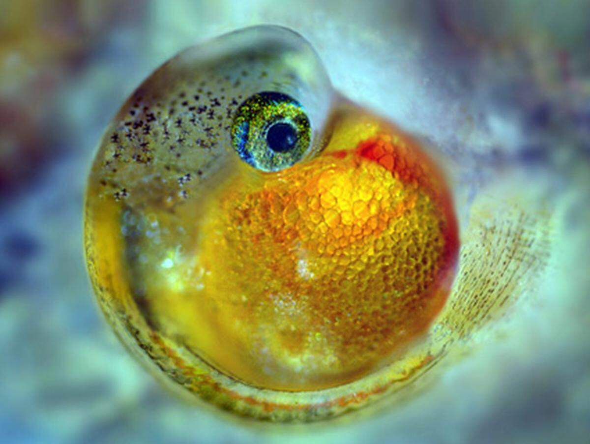 Nikon schreibt alljährlich einen Wettbewerb namens Small World aus. Dabei senden Fotografen Aufnahmen ein, die mit einem Mikroskop gemacht sein müssen, die Verwendung von Nikon-Ausrüstung ist aber nicht zwingend vorgeschrieben. Die Teilnehmer sind auch nicht an irgendwelche speziellen Motive gebunden, wodurch sich eine tolle Vielfalt ergibt.  Embryo eines Guppy-Fisches in 40-facher Vergrößerung. Fotograf: Shamuel Silberman, Ramat-Gan (Israel), 2009