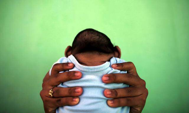 A 4-month-old baby born with microcephaly is held by his mother in front of their house in Olinda