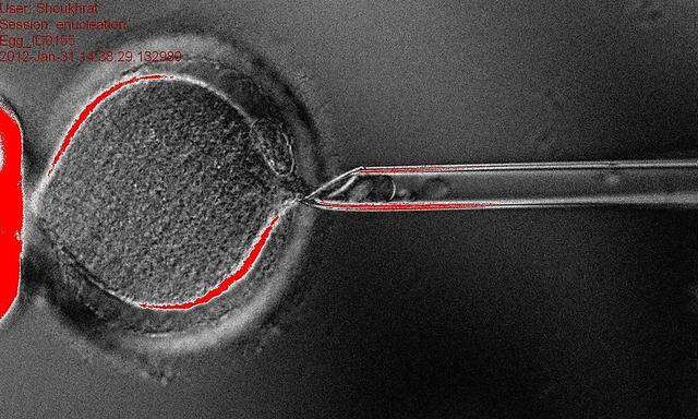 Erstmals menschliche Stammzellen durch Klonen erschaffen