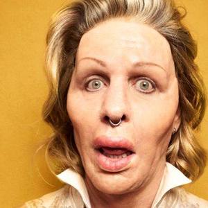 „Botox rein bis ins Gehirn“, singt Rammstein-Sänger Till Lindemann in „Zick Zack“. Passend posiert er im Video als Opfer der Schönheitschirurgie.