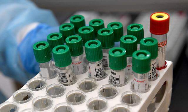 Testproben für PCR-Test