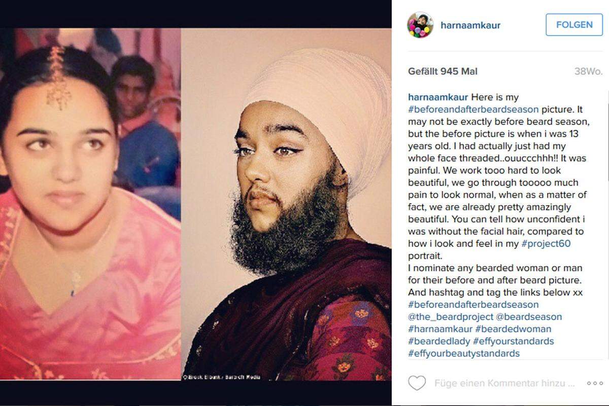 Auf ihrem beliebten Instagram-Account (33.000 Follower) postete Harnaam ein Bild von sich mit 13 Jahren und heute. Sie will Menschen, deren Aussehen aus der Norm fällt, Mut machen.