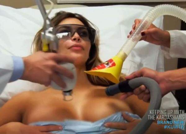 Vor ihrem großen Auftritt am Opernball unterzog sich Kardashian - wie immer vor laufender Kamera - einer Beauty-Behandlung. Mit einer Laserbehandlung bekämpfte sie die Dehnungsstreifen an ihren Brüsten.