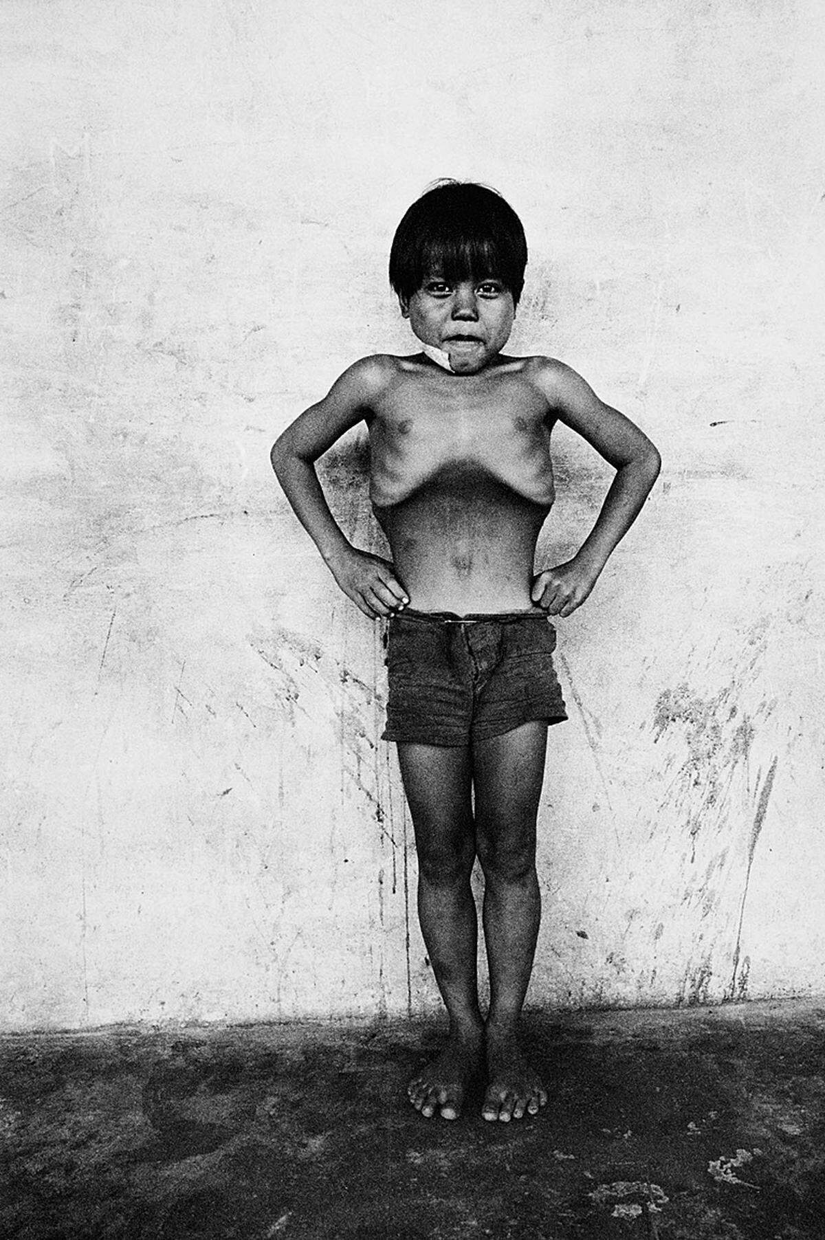 Seine fotografische Karriere begann Ballen in den 1970er Jahren mit der Serie "Boyhood". Nach dem Tod seiner Mutter 1973 ging er auf eine mehrjährige Weltreise, die ihn durch Europa, Asien und auch erstmals nach Südafrika führte.Roger Ballen: "Blown up boy", East Malaysia, 1976 aus der Serie "Boyhood" (c) Roger Ballen