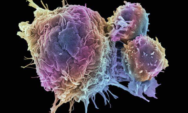 Krebszellen und T-Lymphozyten