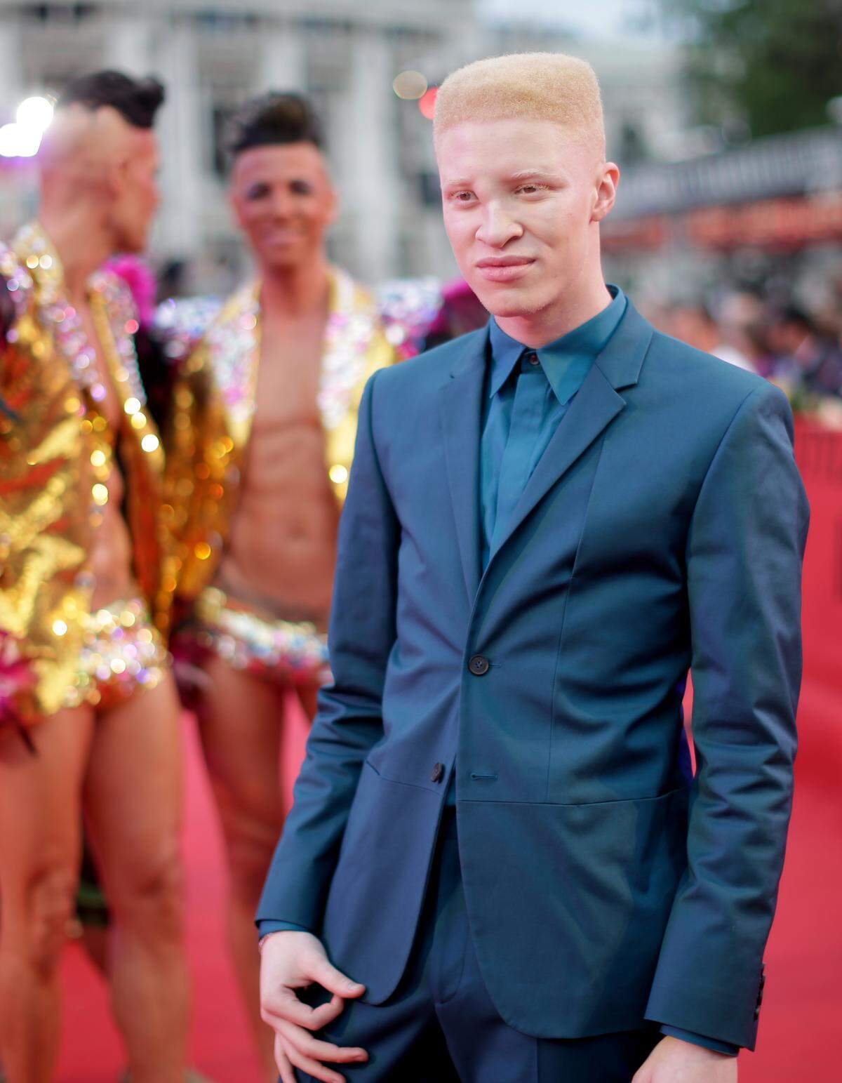 Albino-Model Shaun Ross wird bei der Catwalk-Show über den Runway laufen.