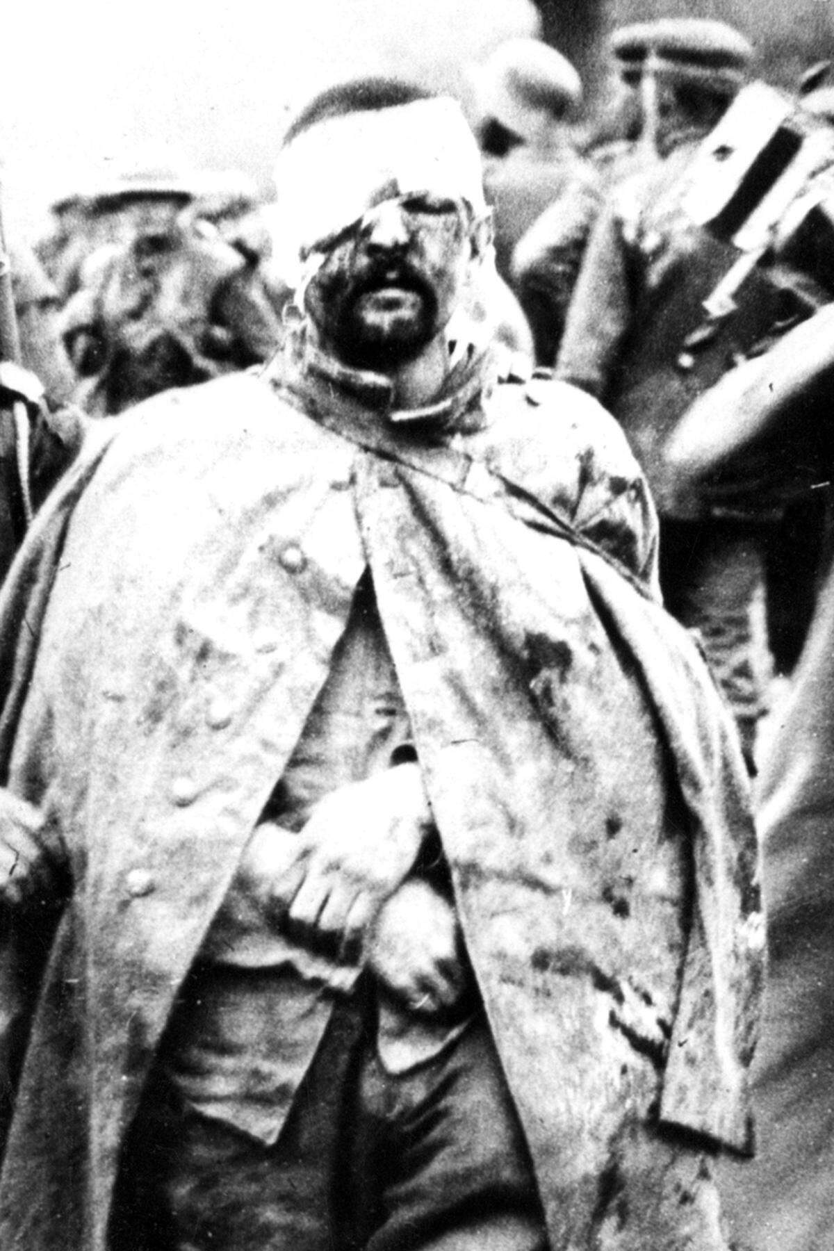 In der Berliner Charité wurde 1918 ein Mann eingeliefert, dessen Gesicht nur noch aus der Stirn, einem Auge und Teilen des Unterkiefers bestand – Ähnliches widerfuhr zahlreichen Soldaten nach dem Beschuss mit Granaten. Die Folge: die plastische Chirurgie entstand.