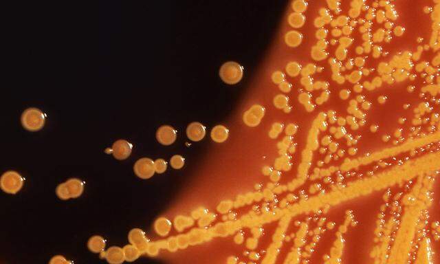 Colonies of E. coli bacteria are seen in a microscopic image courtesy of the CDC