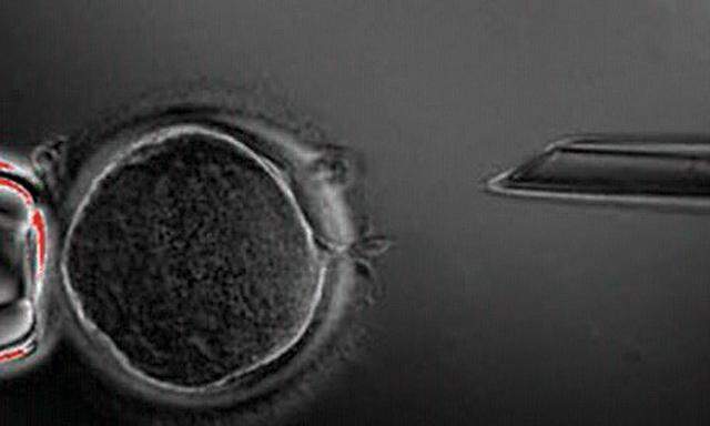 Embryonale Stammzellen 