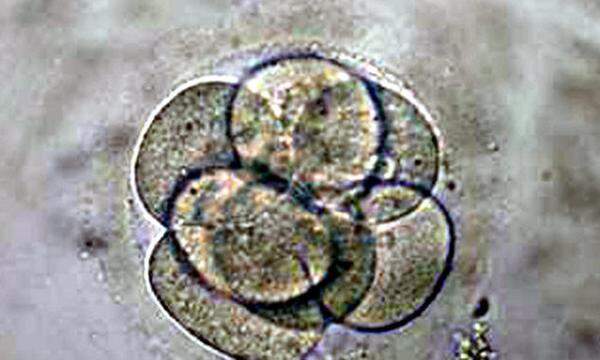 So sieht ein Embryo nach drei Zellteilungen aus. Das Bild wurde 2003 verbreitet,
als südkoreanische Forscher erklärten, sie hätten erstmals menschliche Embryonen geklont. Das erwies sich als Fälschung.