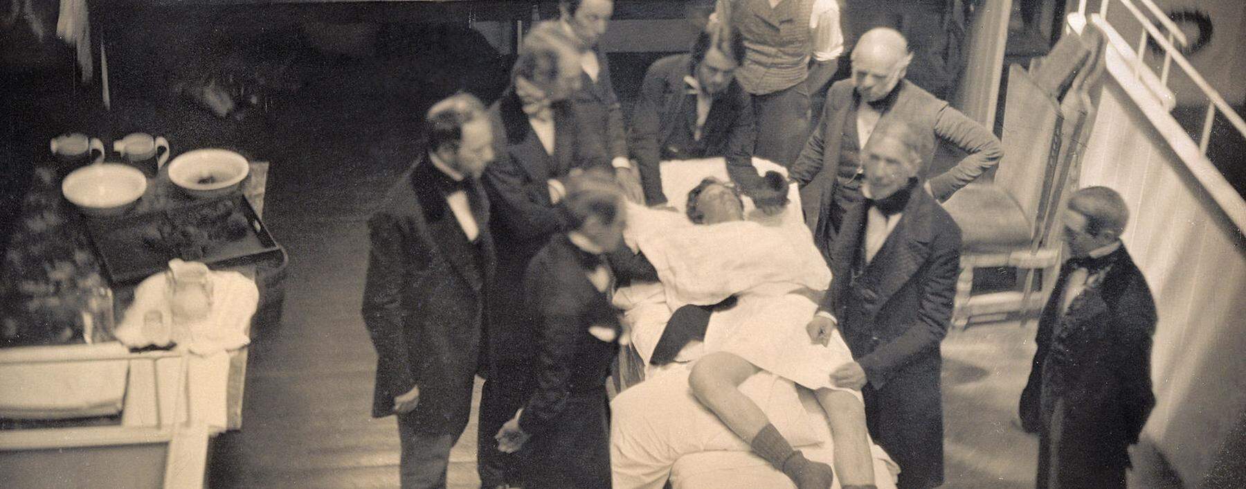 Der Patient scheint zu schlafen. Die erste Operation mit Äthernarkose erfolgte in den USA (Boston). Hier ein Foto von 1846/47.