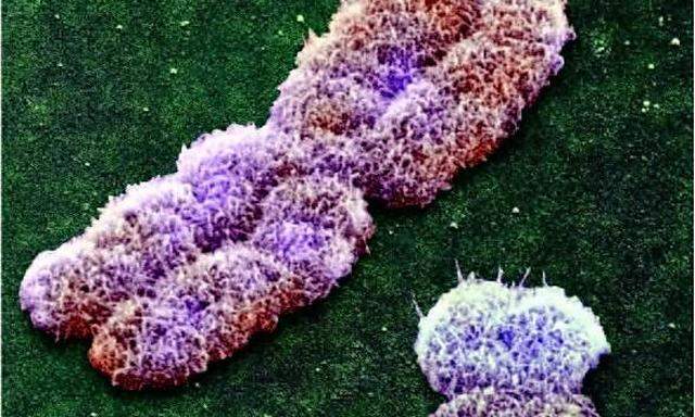 Wie viele Chromosomen sieht es X-förmig aus: das X-Chromosom des Menschen unter dem Elektronenmikroskop. Daneben liegt das deutlich kleinere Y-Chromosom, das Männer anstelle eines zweiten X-Chromosoms in ihrem Genom haben – also in allen ihren Zellkernen.