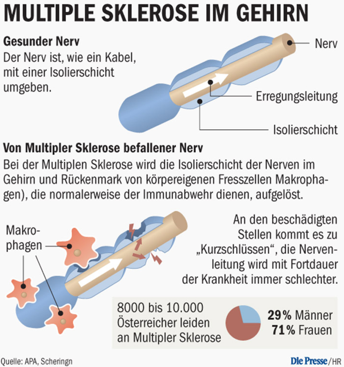 Frühe Therapie bei Multipler Sklerose – DiePresse.com