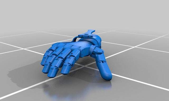Hand-Prothesen aus dem 3D-Drucker