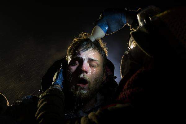 Dieses Foto eines Mannes, der mit Magnesiumhydroxid gegen die Wirkung von Pfefferspray behandelt wird, gehört zur Serie "Standing Rock" von Amber Bracken. Umweltschützer und die Ureinwohner Standing Rock Sioux protestieren in North Dakota gegen den Bau der Dakota Access Pipeline. Bei diesem Protest im November wurden mehrere Menschen verletzt, weil die Polizei trotz Minusgraden Wasserwerfer einsetzte.  