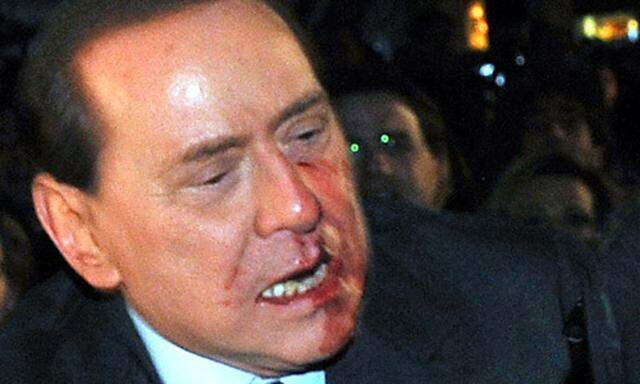 Berlusconis Nasenbein ist gebrochen, der Premier ist noch im Spital